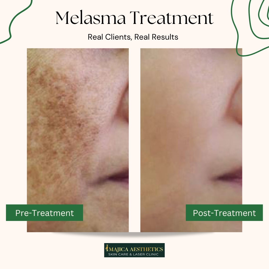 474081943_1155226415961734_3486812869339095772_n